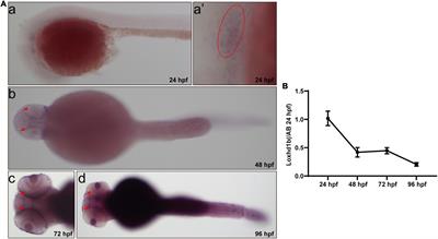 Loxhd1b inhibits the hair cell development in zebrafish: Possible relation to the BDNF/TrkB/ERK pathway